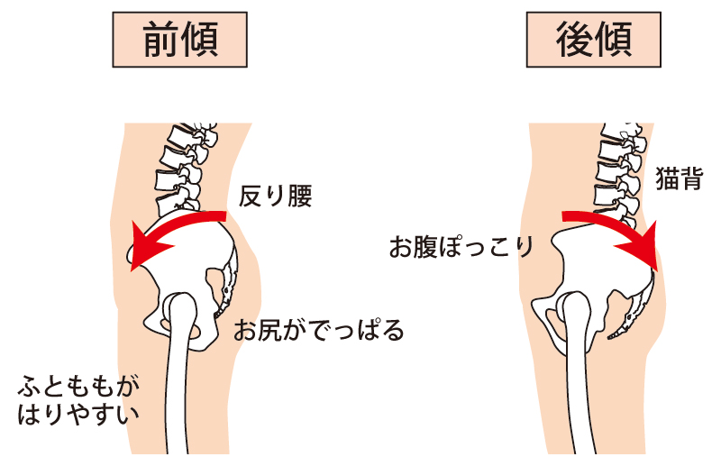 骨盤の歪みや傾きが原因で脚・膝の歪みに繋がることもあります