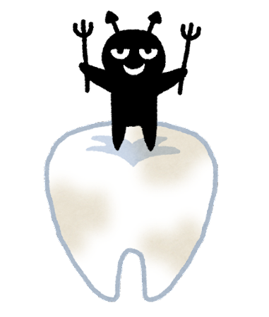 虫歯菌が原因で歯の痛みが生じるイラスト